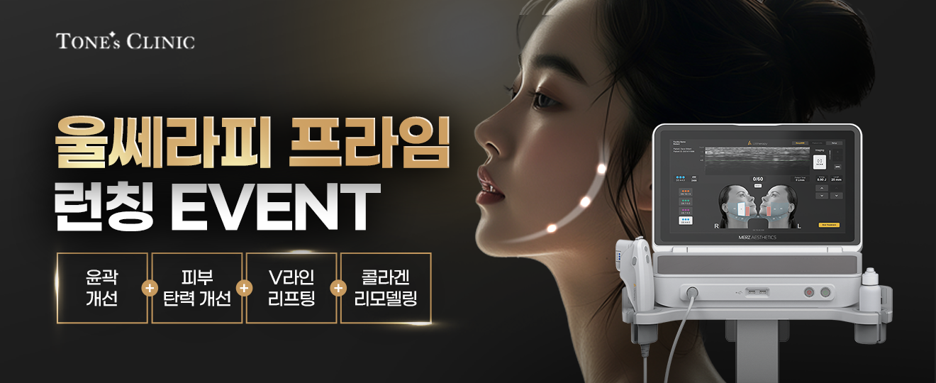 팝업